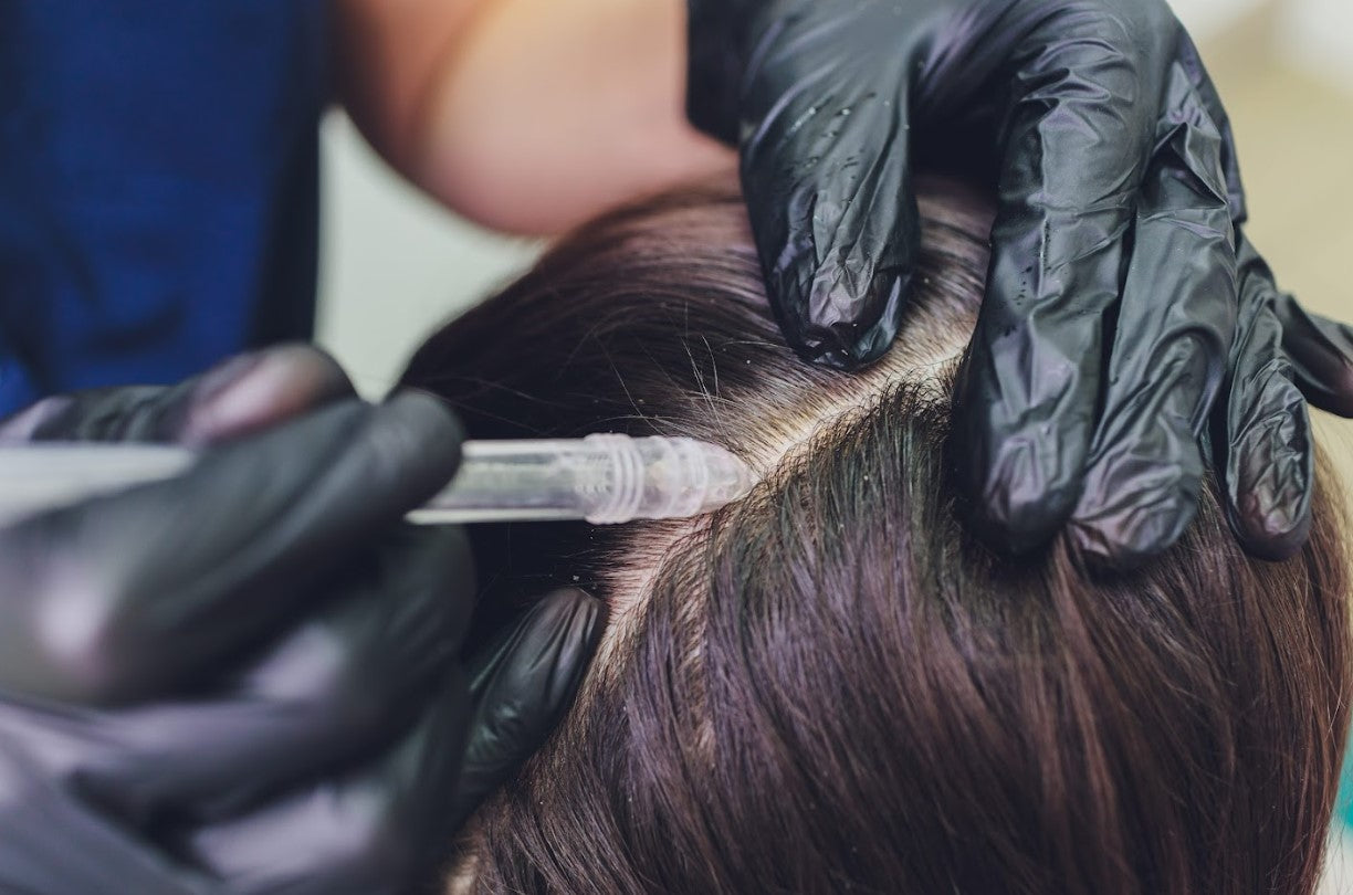 air peeling dandruff cleansing scalp treatment designed to remove buildup, soothe irritation, and promote a healthier, flake-free scalp